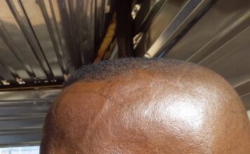 Man bullied and abused by mother of child and new boyfriend